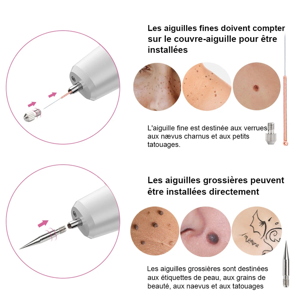 Skin Tag & Mole Remover Pen — Gentle Spot Correction, lifestyle setting