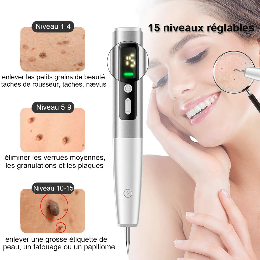 Skin Tag & Mole Remover Pen — Gentle Spot Correction, alternate angle