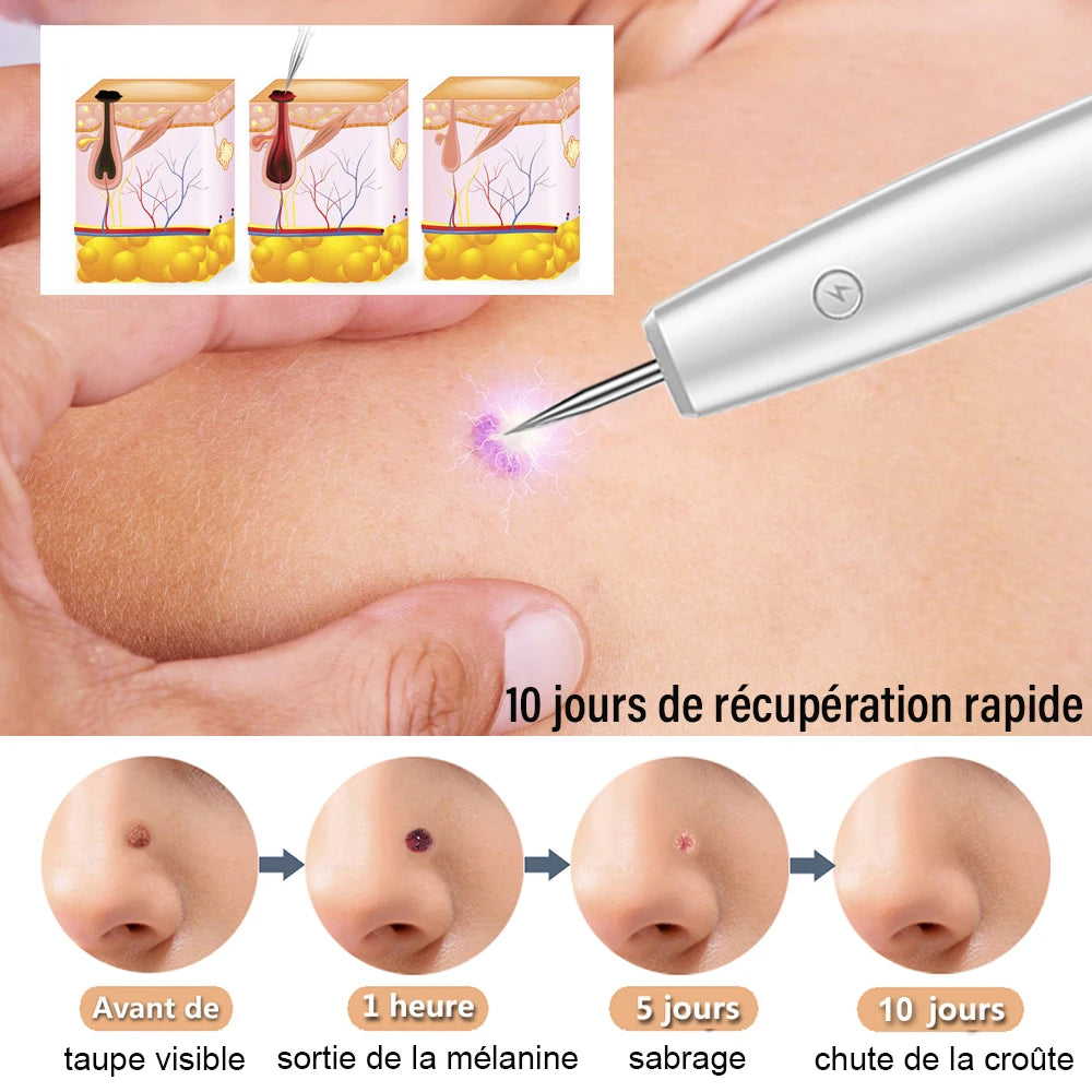 Skin Tag & Mole Remover Pen — Gentle Spot Correction, natural styling